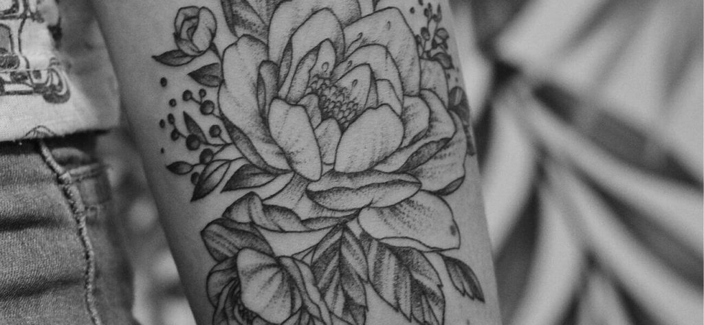 Tattoo Removal